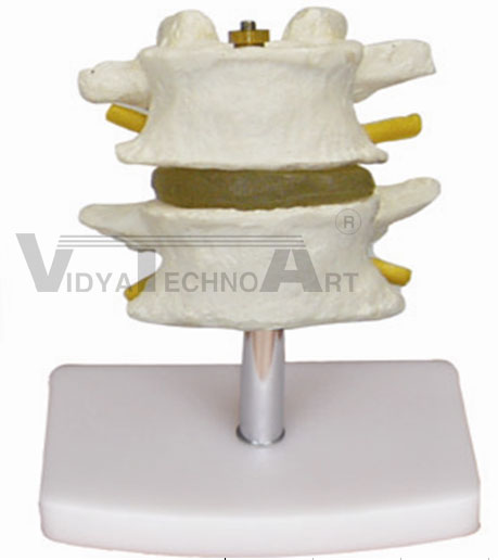 Lumbar Set Pharmaceutical and Anatomical Model Gifts